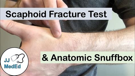 scaphoid fracture compression test|scaphoid fracture clinical exam.